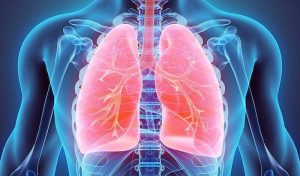 Có rất nhiều người mắc phải lao kháng thuốc