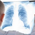 Giải đáp từ chuyên gia: Bệnh lao phổi có quan hệ được không? 