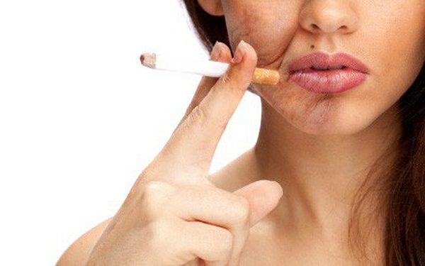 Hút thuốc gây ảnh hưởng đến làn da
