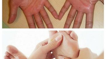 PHƯƠNG PHÁP TRỊ MỒ HÔI TAY CHÂN ĐÚNG CÁCH
