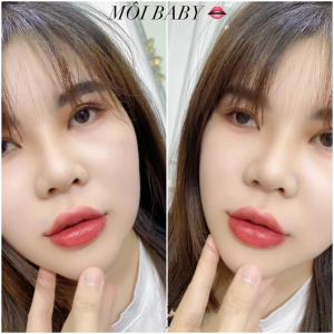 Khuyến mãi 50% – Anchee Clinic tặng khách hàng phun môi thẩm mỹ 