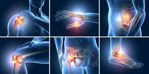 Đau nhức xương khớp tê bì chân tay là tình trạng rất thường gặp ở nhiều lứa tuổi khác nhau